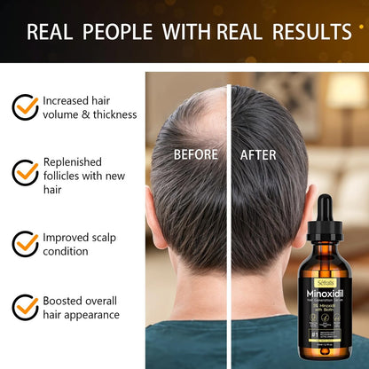 2-Pack 5% Minoxidil Hair Growth Serum for Men and Women - Hair Regrowth Treatment for Stronger, Thicker, Longer Hair & Facial Hair Grooming Avelisse