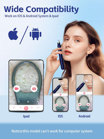 Visual Blackhead Remover Tool with Camera - 20X 1080P Pimple Popper Extractor Kit for iPhone/Android (Blue) Avelisse
