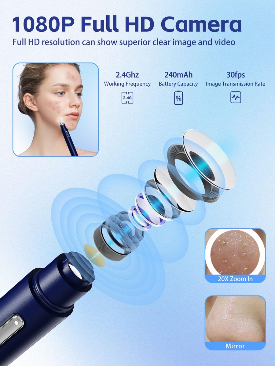 Visual Blackhead Remover Tool with Camera - 20X 1080P Pimple Popper Extractor Kit for iPhone/Android (Blue) Avelisse