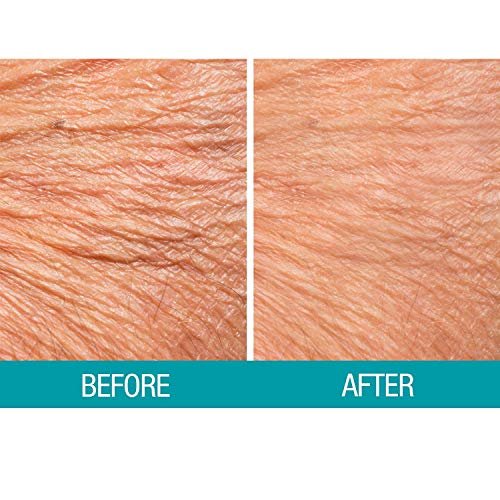 Dermactin Crepe Be Gone Body Souffle - Ultra Hydrating Crepe Skin Firming Cream for Neck, Chest, Arms & Legs - Classic 3 oz - görsel 14