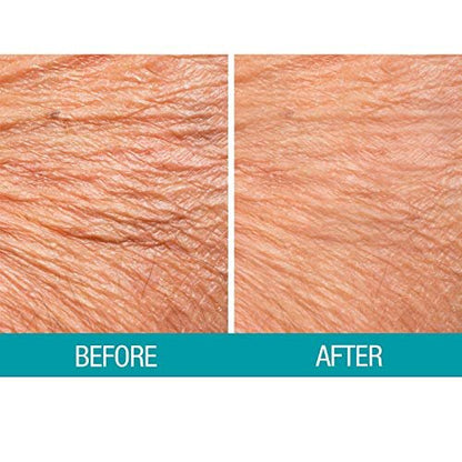 Dermactin Crepe Be Gone Body Souffle - Ultra Hydrating Crepe Skin Firming Cream for Neck, Chest, Arms & Legs - Classic 3 oz