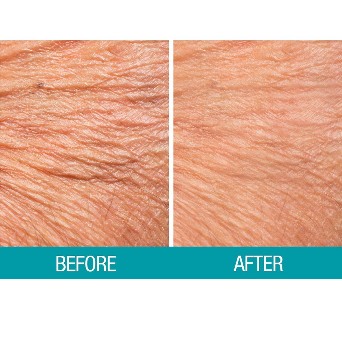 Dermactin Crepe Be Gone Body Souffle - Ultra Hydrating Crepe Skin Firming Cream for Neck, Chest, Arms & Legs - Classic 3 oz - görsel 13
