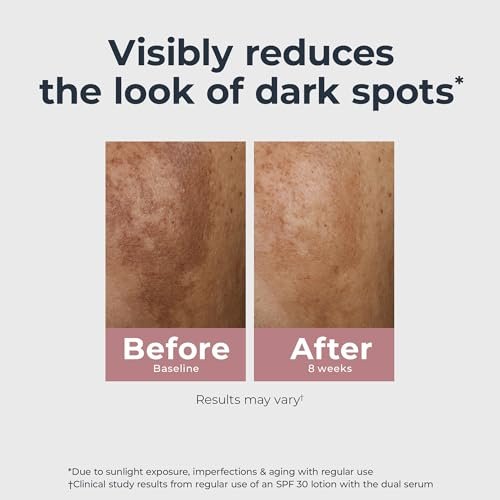 Eucerin Radiant Tone Dual Serum Dark Spot Corrector with Thiamidol and Hyaluronic Acid, 1 Fl Oz Avelisse