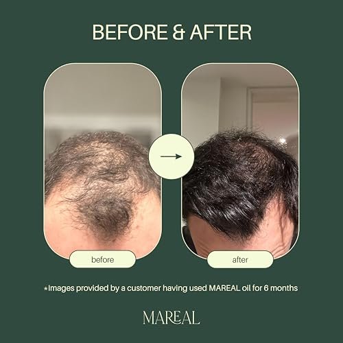 MAREAL Pure Rosemary Oil for Hair Growth & Scalp Health | Infused with Castor & Coconut Oil | Hair Thickening & Regrowth Treatment for Women & Men | 100% Natural | Up to 3-Month Supply | 1.7 fl oz Avelisse