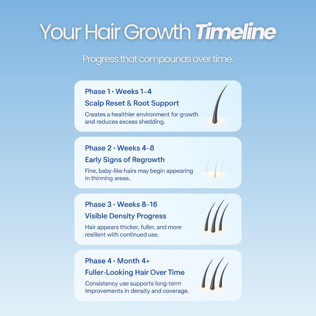 Growplex Vitafoam 5% Minoxidil Foam for Men & Women – DHT Blocking, Non-Greasy, Fast-Drying Hair Regrowth Treatment Avelisse