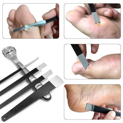 36 Pcs Callus Shaver for Feet Set – Professional Stainless Steel Callus Remover for Wet & Dry Feet with 30 Replacement Blades