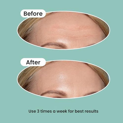 NURIVE Advanced Wrinkle Patches 20ct - Large (Forehead) | Invisible Overnight Wrinkle Tape with Retinol & Collagen for Smile Lines & Frown Lines Avelisse