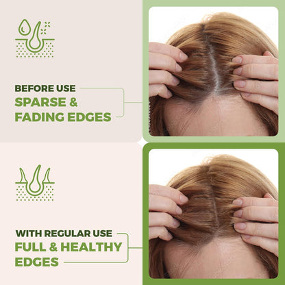 Going Batanas Premium Batana Oil for Hair Growth Blend - 100% Natural Batana from Honduras, Castor & Rosemary Oil - Natural Hair Products for Women & Men (4 Fl Oz) Avelisse