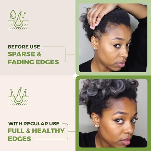 Going Batanas Premium Batana Oil for Hair Growth Blend - 100% Natural Batana from Honduras, Castor & Rosemary Oil - Natural Hair Products for Women & Men (4 Fl Oz) Avelisse