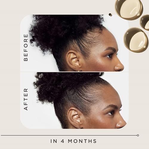 Carol's Daughter Goddess Strength Hair Regrowth Treatment for Women, 2% Minoxidil Solution for Hair Loss and Thinning, One Month Supply, 2 Fl Oz Avelisse