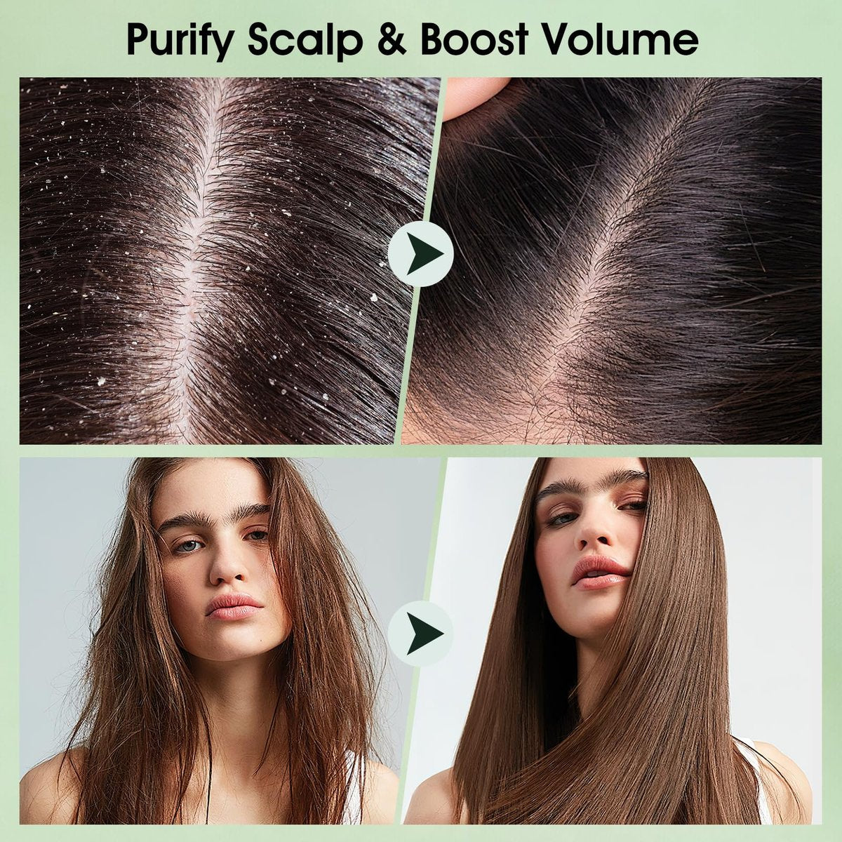 VOERUY Scalp Scrub with Tea Tree & Mint Oil – 2-in-1 Exfoliating Scalp Treatment for Clarifying & Removing Build-up, Includes Silicone Scalp Massager, 10.6 oz (300g) - görsel 7