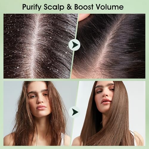VOERUY Scalp Scrub with Tea Tree & Mint Oil – 2-in-1 Exfoliating Scalp Treatment for Clarifying & Removing Build-up, Includes Silicone Scalp Massager, 10.6 oz (300g) - görsel 8