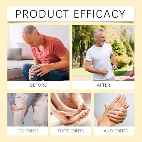 OSFRIAGE Bee Venom Joint Gel – Professional Strength Joint & Bone Cream for Back, Knee, Hands, Neck, Feet (2-Pack, 60g Each) Avelisse