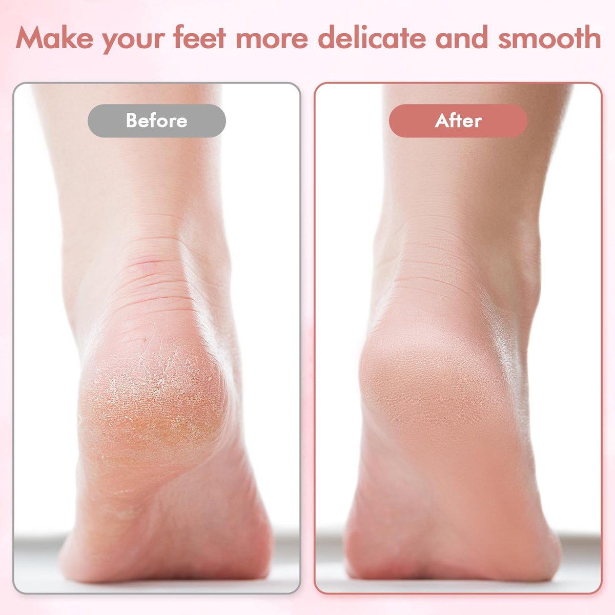 Professional Electric Foot File and Callus Remover - Smooth Cracked, Hard, Dead Skin with 2 Grinding Heads & Cleaning Brush - görsel 6