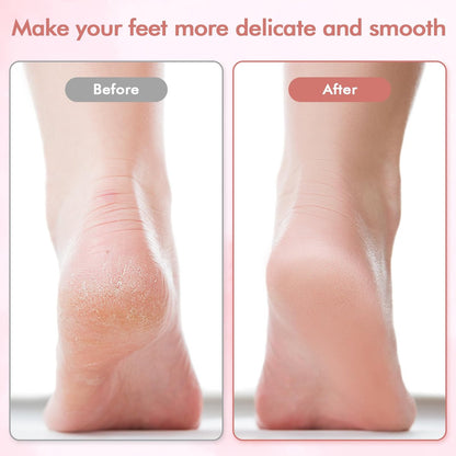 Professional Electric Foot File and Callus Remover - Smooth Cracked, Hard, Dead Skin with 2 Grinding Heads & Cleaning Brush