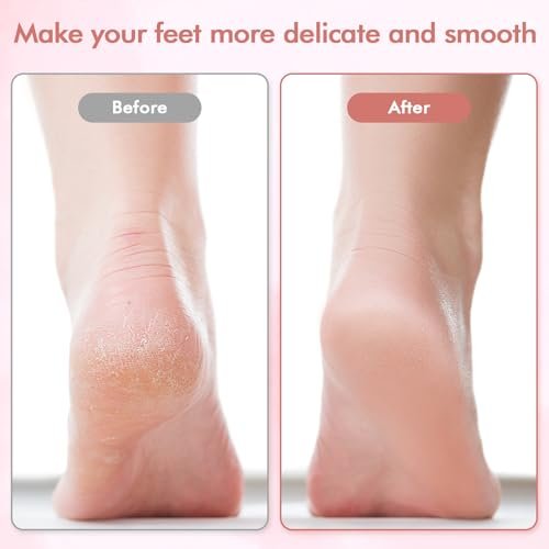 Professional Electric Foot File and Callus Remover - Smooth Cracked, Hard, Dead Skin with 2 Grinding Heads & Cleaning Brush - görsel 5