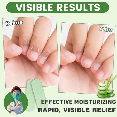 TEAWOO 50PCS Aloe Vera Cracked Hands Treatment Patches - Dry Cracked Hands Repair Bandage - görsel 6
