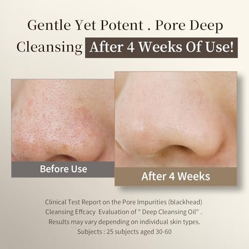 COSMOO Deep Cleansing Oil – Pore Control Oil Cleanser for Makeup Removal & Blackhead Care, Korean Skin Care, All Skin Types, 6.76 fl oz - görsel 10