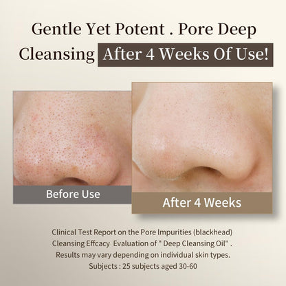 COSMOO Deep Cleansing Oil – Pore Control Oil Cleanser for Makeup Removal & Blackhead Care, Korean Skin Care, All Skin Types, 6.76 fl oz