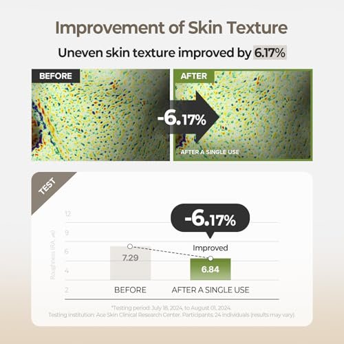 SKINFOOD Rice Brightening Toner - Vegan Korean Skincare with Fermented Rice Water for Glass Skin, Pore Minimizing & Hydrating, 5.41 fl oz Avelisse