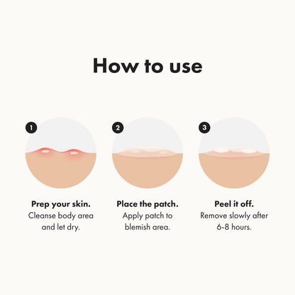 Mighty Patch Hero Body Patch – XXL Hydrocolloid Patch for Bacne, Chestne & Body Breakouts (4 Count)