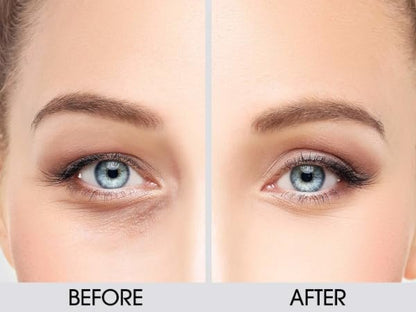 Dermactin Classic Upper Eyelid Revitalizing Eye Cream – 1 oz. Firming & Hydrating Formula Avelisse