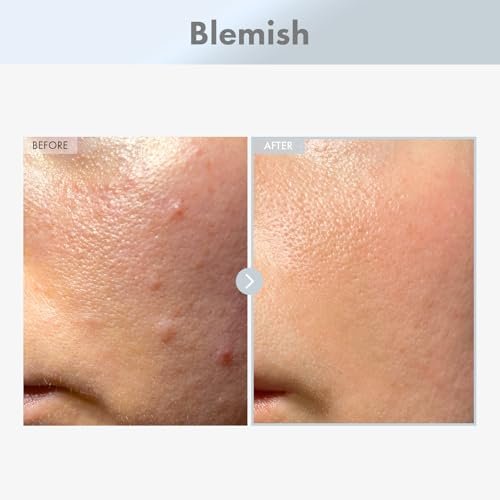 TOSOWOONG Niacinamide 15% Face Serum – Dark Spot Corrector, Pore Minimizer, Glass Skin, Korean Skincare, 30ml - görsel 4