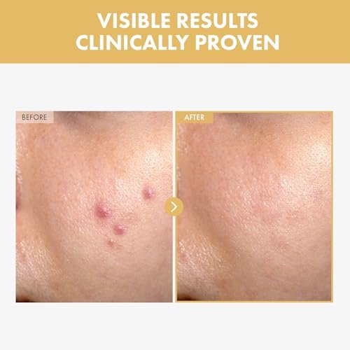 TOSOWOONG Black Snail Ginseng Serum – Hydrating Facial Moisturizer with Snail Mucin & Ginseng 640,430ppm for Glowing Skin, Acne Scar Remover, Korean Skin Care, 30ml - görsel 3