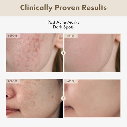 TOSOWOONG Alpha Arbutin 2% Rice Serum – Brightening & Hydrating Korean Skin Care for Glass Skin, 33ml Avelisse