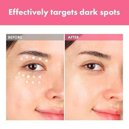 TOSOWOONG Arbutin 7% Intensive Spot Cream – Dark Spot Corrector with Tranexamic Acid & Niacinamide | Korean Skin Care 20ml