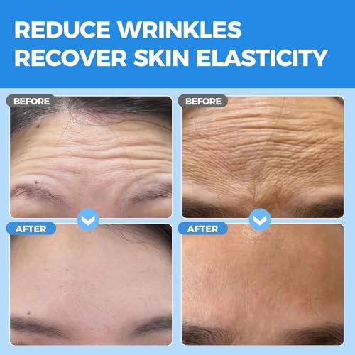 Okela Forehead Wrinkle Patches Overnight with Collagen - 20 Patches for Anti-Aging Beauty Treatment - görsel 4