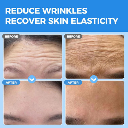 Okela Forehead Wrinkle Patches Overnight with Collagen - 20 Patches for Anti-Aging Beauty Treatment