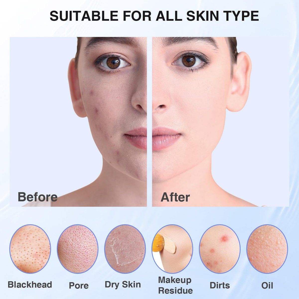 5 Modes Silicone Face Scrubber - Waterproof Electric Facial Cleansing Brush for Deep Cleansing, Exfoliating & Massage (Blue) - görsel 11