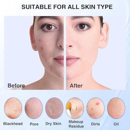 5 Modes Silicone Face Scrubber - Waterproof Electric Facial Cleansing Brush for Deep Cleansing, Exfoliating & Massage (Blue)