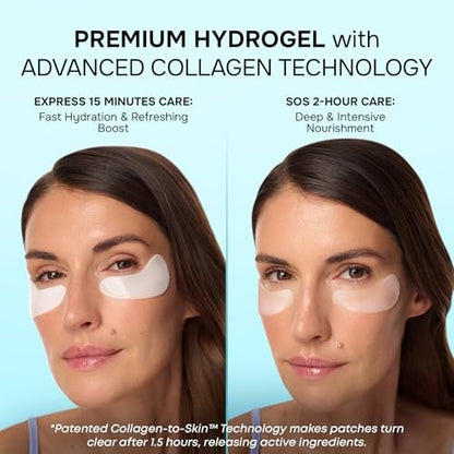 Under Eye Patches for Puffy Eyes and Dark Circles - Cooling Eye Masks with Collagen, Hyaluronic Acid & Retinol - Depuffing Undereye Mask Patches - 15 Pairs