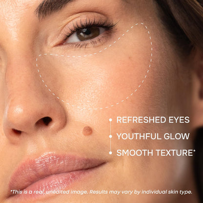 Under Eye Patches for Puffy Eyes and Dark Circles - Cooling Eye Masks with Collagen, Hyaluronic Acid & Retinol - Depuffing Undereye Mask Patches - 15 Pairs