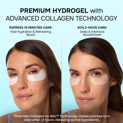 Under Eye Patches for Puffy Eyes and Dark Circles - Cooling Eye Masks with Collagen, Hyaluronic Acid & Retinol - Depuffing Undereye Mask Patches - 15 Pairs