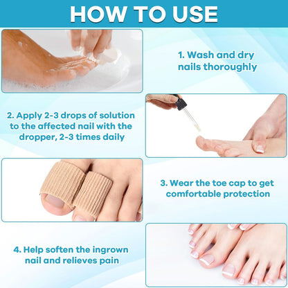 Ingrown Toenail Drop - Effective Pain Reliever and Softener Kit for Men and Women, Ingrown Toenail Corrector Drops, 1 Fl Oz Avelisse