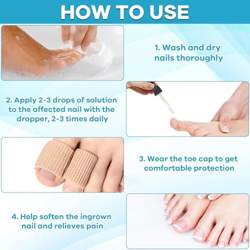 Ingrown Toenail Drop - Effective Pain Reliever and Softener Kit for Men and Women, Ingrown Toenail Corrector Drops, 1 Fl Oz Avelisse