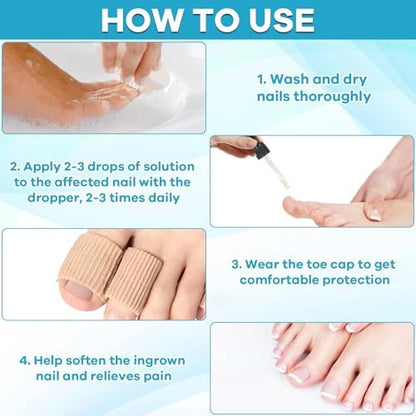 Ingrown Toenail Drop - Effective Pain Reliever and Softener Kit for Men and Women, Ingrown Toenail Corrector Drops, 1 Fl Oz Avelisse