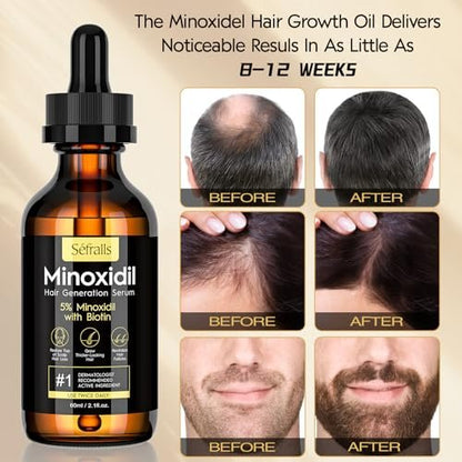 5% Minoxidil Hair Growth Oil for Men & Women Kit - Extra Strength Regrowth Serum, Topical Hair Loss Treatment, Thicker Healthier Hair & Beard Growth Kit, 2.11 fl.oz Avelisse