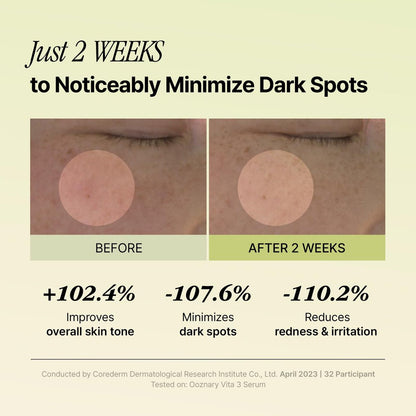 Ooznary Vita 3 Serum with Vitamin C Derivatives, Niacinamide, and Glutathione – Korean Skin Care for Uneven Skin Tone & Dull Skin, 1.69 fl.oz (50ml) Avelisse