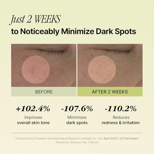 Ooznary Vita 3 Serum with Vitamin C Derivatives, Niacinamide, and Glutathione – Korean Skin Care for Uneven Skin Tone & Dull Skin, 1.69 fl.oz (50ml) Avelisse