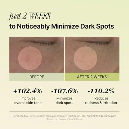 Ooznary Vita 3 Serum with Vitamin C Derivatives, Niacinamide, and Glutathione – Korean Skin Care for Uneven Skin Tone & Dull Skin, 1.69 fl.oz (50ml) Avelisse