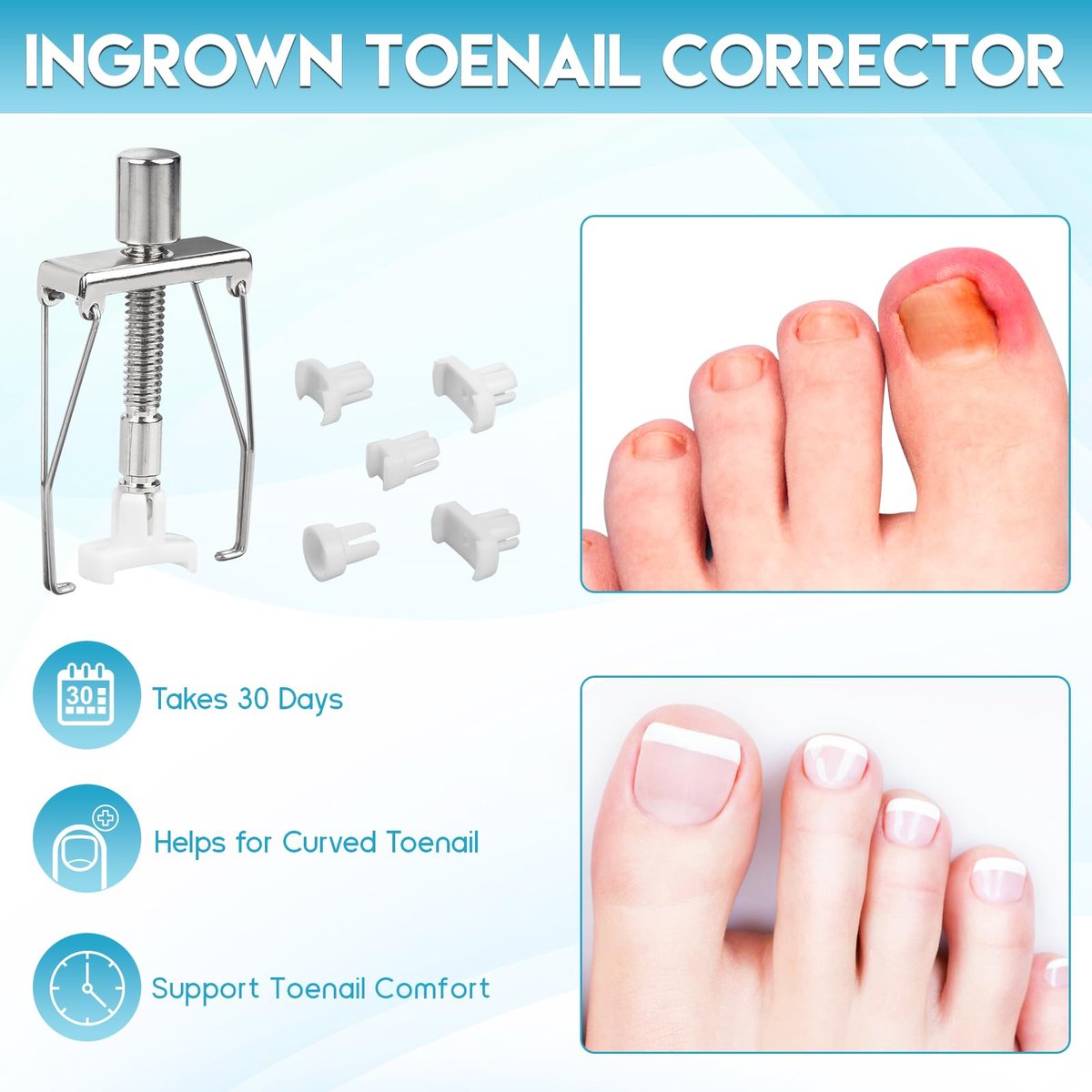Professional Ingrown Toenail Removal Kit - Complete Stainless Steel Tool Set with Corrector Drops, Patches, Clipper, and File Lifter - görsel 12