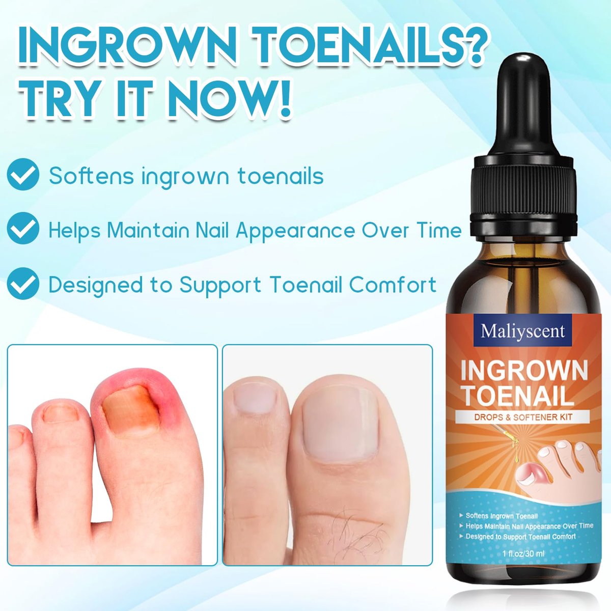 Professional Ingrown Toenail Removal Kit - Complete Stainless Steel Tool Set with Corrector Drops, Patches, Clipper, and File Lifter - görsel 6
