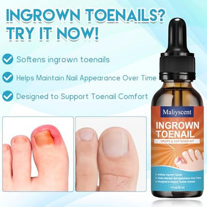Professional Ingrown Toenail Removal Kit - Complete Stainless Steel Tool Set with Corrector Drops, Patches, Clipper, and File Lifter