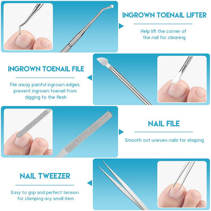 Professional Ingrown Toenail Removal Kit - Complete Stainless Steel Tool Set with Corrector Drops, Patches, Clipper, and File Lifter