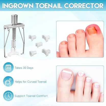 Professional Ingrown Toenail Removal Kit - Complete Stainless Steel Tool Set with Corrector Drops, Patches, Clipper, and File Lifter