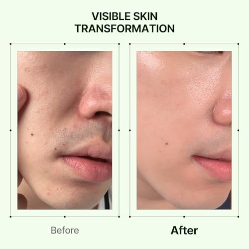 Orien Mugwort Collagen Pore Serum - 1.01 fl oz | Firming & Pore Minimizing Face Serum Avelisse